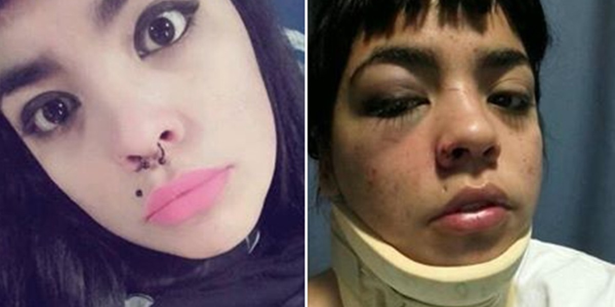 Ataque violento en Bahía Blanca: una joven denunció que la golpearon e intentaron violarla | Actualidad