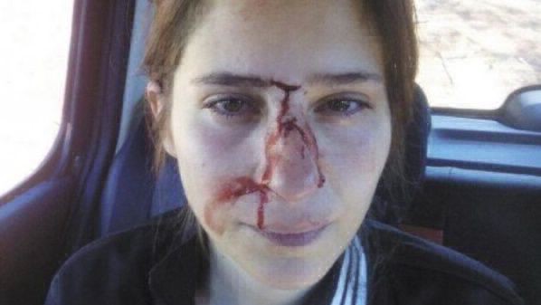 El calvario de la violencia de género en primera persona: "Decía que me pegaba por el bien de nuestra relación" | Actualidad