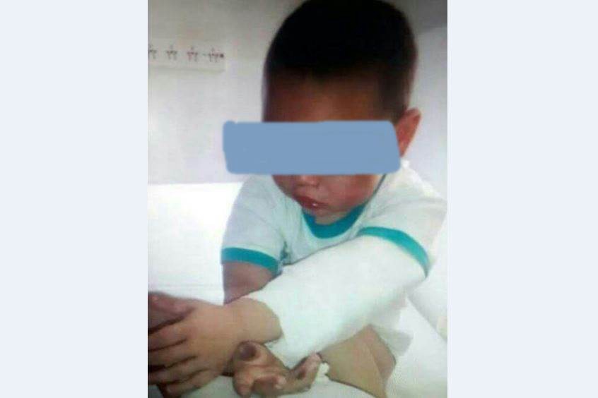 Detienen y trasladan a un joven acusado de abusar y golpear al pequeño hijo de su pareja | Actualidad