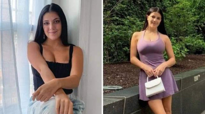 Modelo contó cómo es su vida con útero doble: "No causa problema pero se nota" | Internacionales