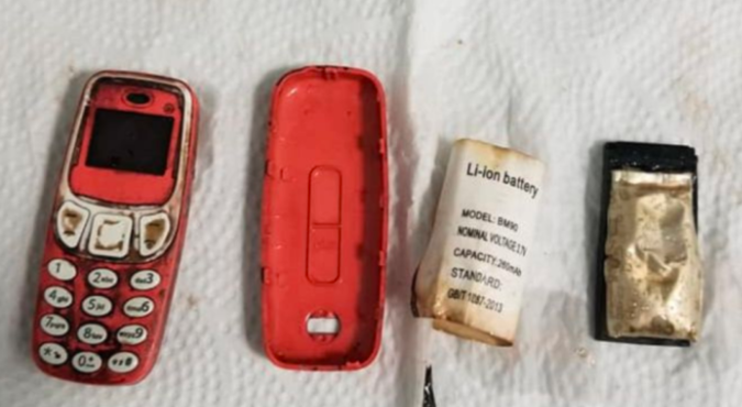 Tuvieron que operarlo de urgencia para sacarle del estómago un celular que se había tragado | Internacionales