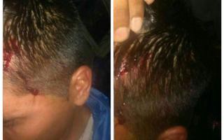 Un pasajero agredió a un colectivero en Avellaneda | Actualidad