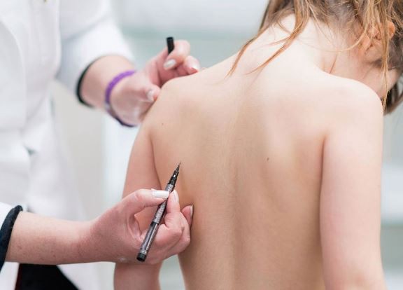 Escoliosis: buscan incluir su detección en los controles de salud de los colegios | Actualidad