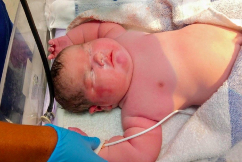 "Todo el mundo se reía cuando salía la cabeza": nació por parto vaginal un bebé de 6,7 kilos | Internacionales