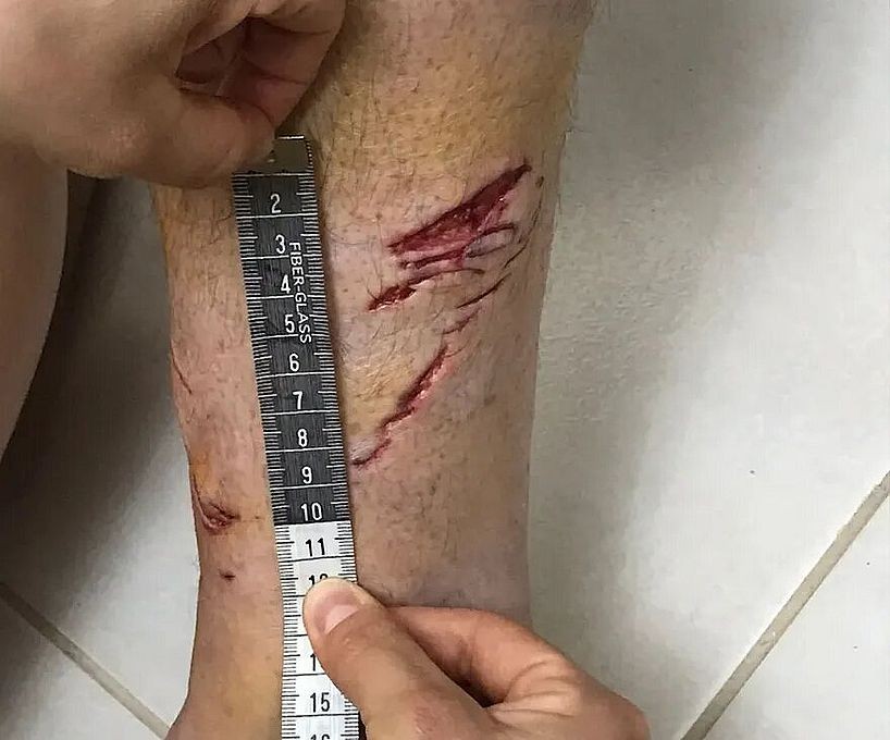 Un tiburón mordió a un turista en una playa del sureste de Brasil | Internacionales