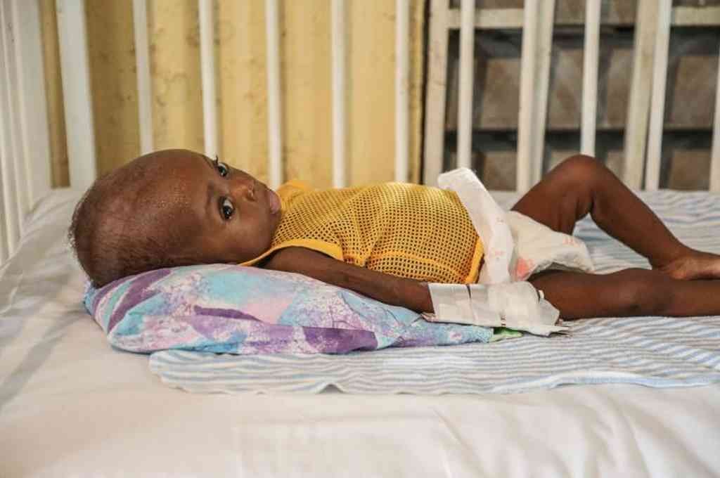 Unos 200 niños murieron de hambre en hospitales de Etiopía | Internacionales