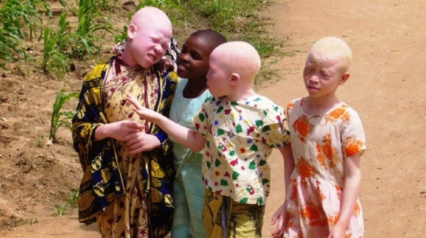 Decapitaron a un hombre calvo en Mozambique: creen que tiene oro en la cabeza | Internacionales