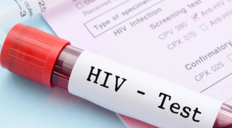 Identifican una variante del VIH más virulenta que circula desde hace décadas en Países Bajos | Internacionales