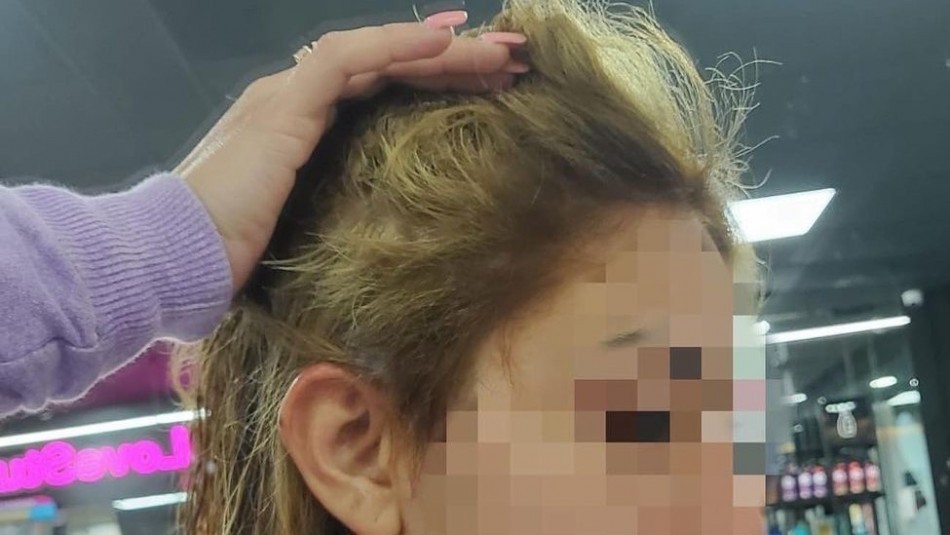 Fue a la peluquería para un cambio de look y se le cayó el pelo: le ofrecieron una peluca como consuelo | Internacionales
