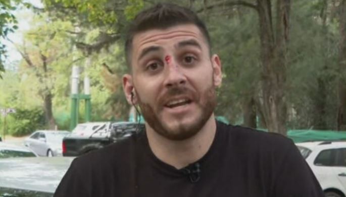 Acceso Oeste: recibió una golpiza frente a su familia por quejarse de que casi lo chocan | Actualidad