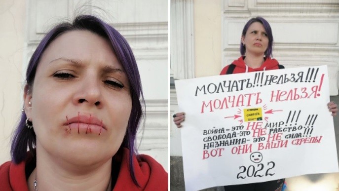 "No se puede estar callado": se cosió la boca en protesta por la invasión rusa a Ucrania | Internacionales