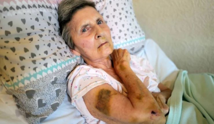 Una abuela fue atacada en el rostro por una rata mientras dormía | Internacionales