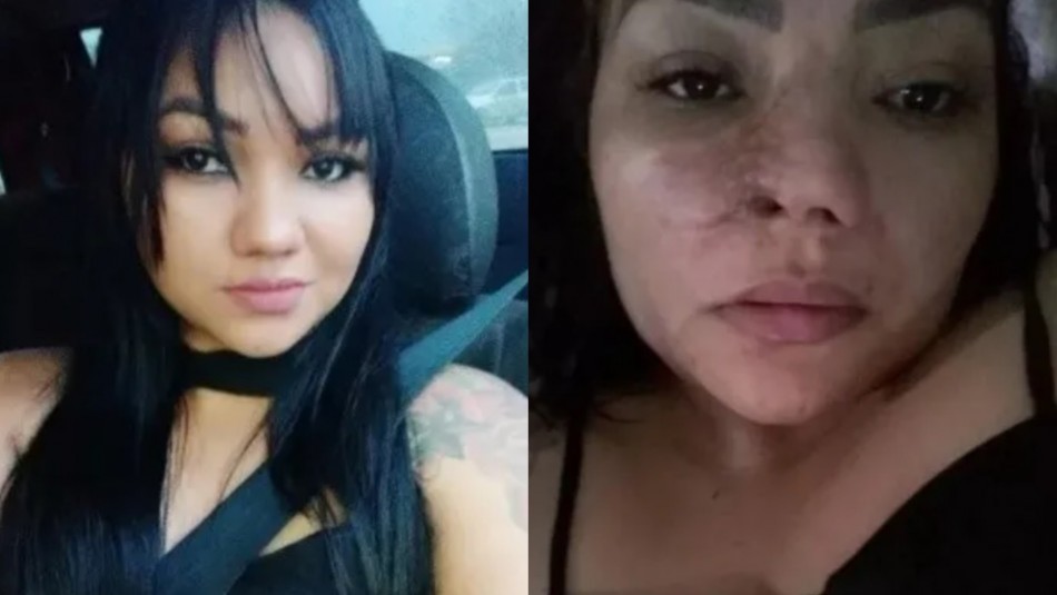 Se operó la nariz y quedó desfigurada: se enteró que fue intervenida por un dentista | Internacionales