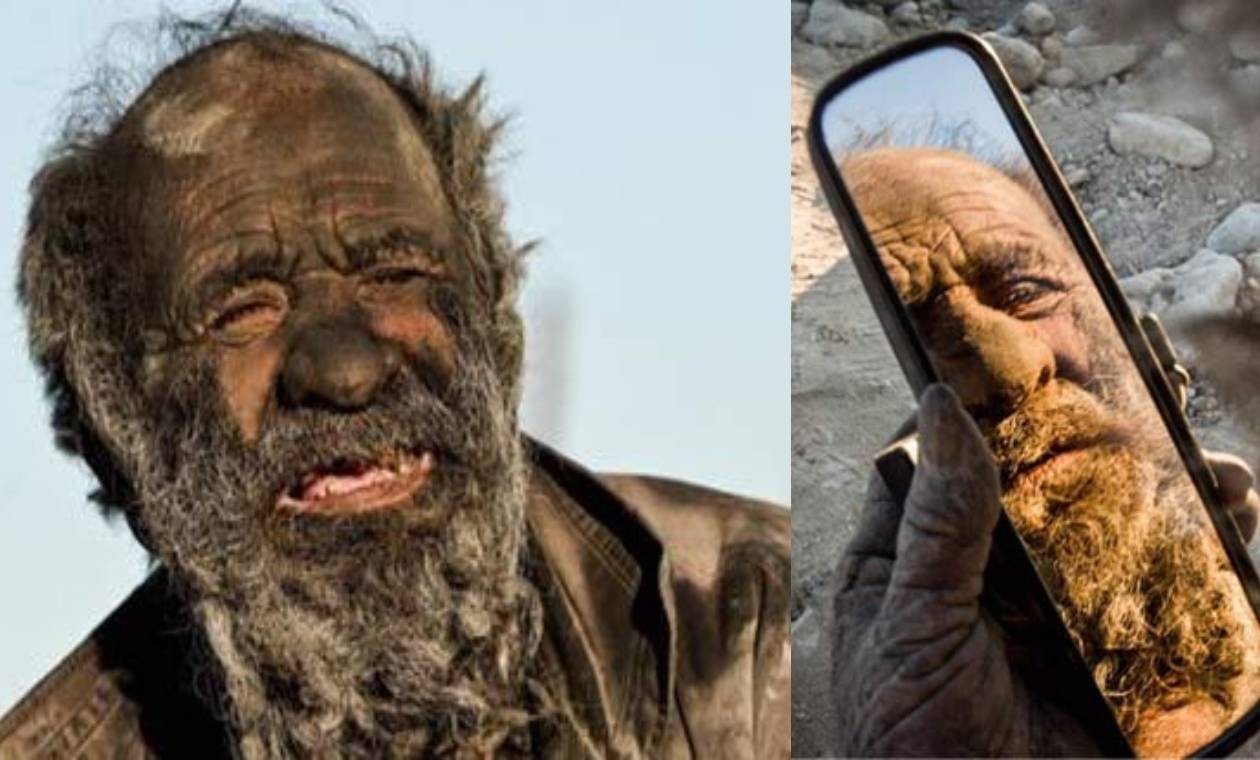 Murió "el hombre más sucio del mundo": por qué estuvo medio siglo sin bañarse | Internacionales