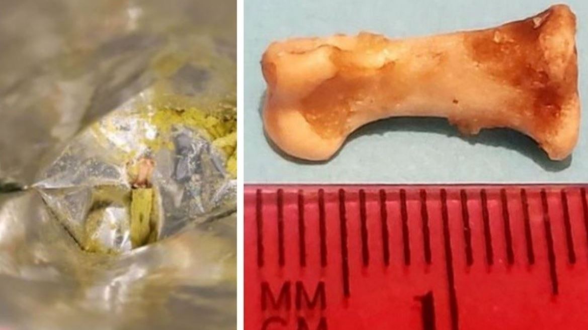 Abrió un paquete de snacks y encontró un hueso de dedo | Internacionales