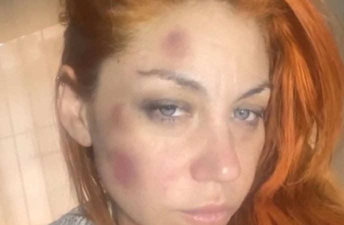 Lourdes, ex cantante de Bandana, denunció a su ex pareja por violencia de género | Espectáculos