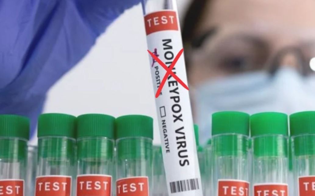 Cambiaron el nombre a la viruela del mono por considerarlo un "lenguaje racista y estigmatizante" | Internacionales