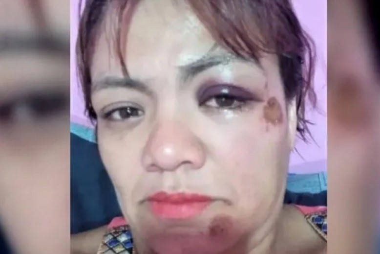 Contó en redes que fue atacada por una jauría y que la Policía no quiso tomarle la denuncia | Actualidad