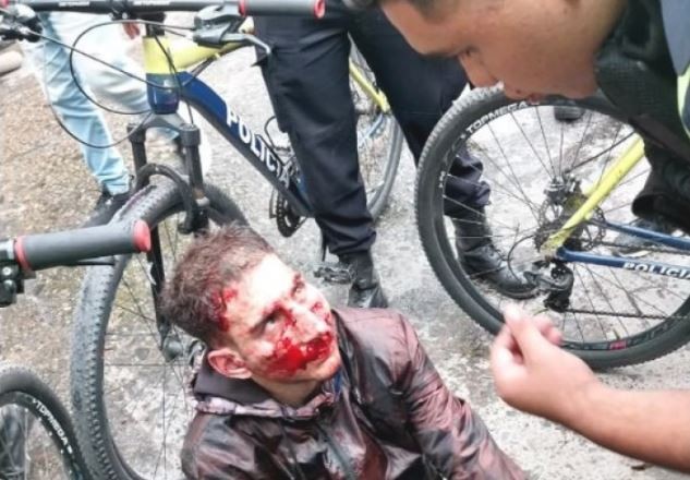 Vecinos detuvieron a un motochorro y descubrieron que era un policía | Actualidad