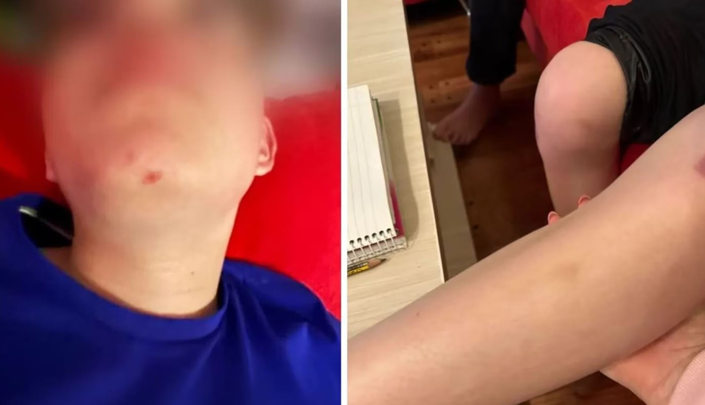 Nene de 10 años entró por error en la cancha de golf de un country y una pareja lo atacó a pelotazos | Actualidad