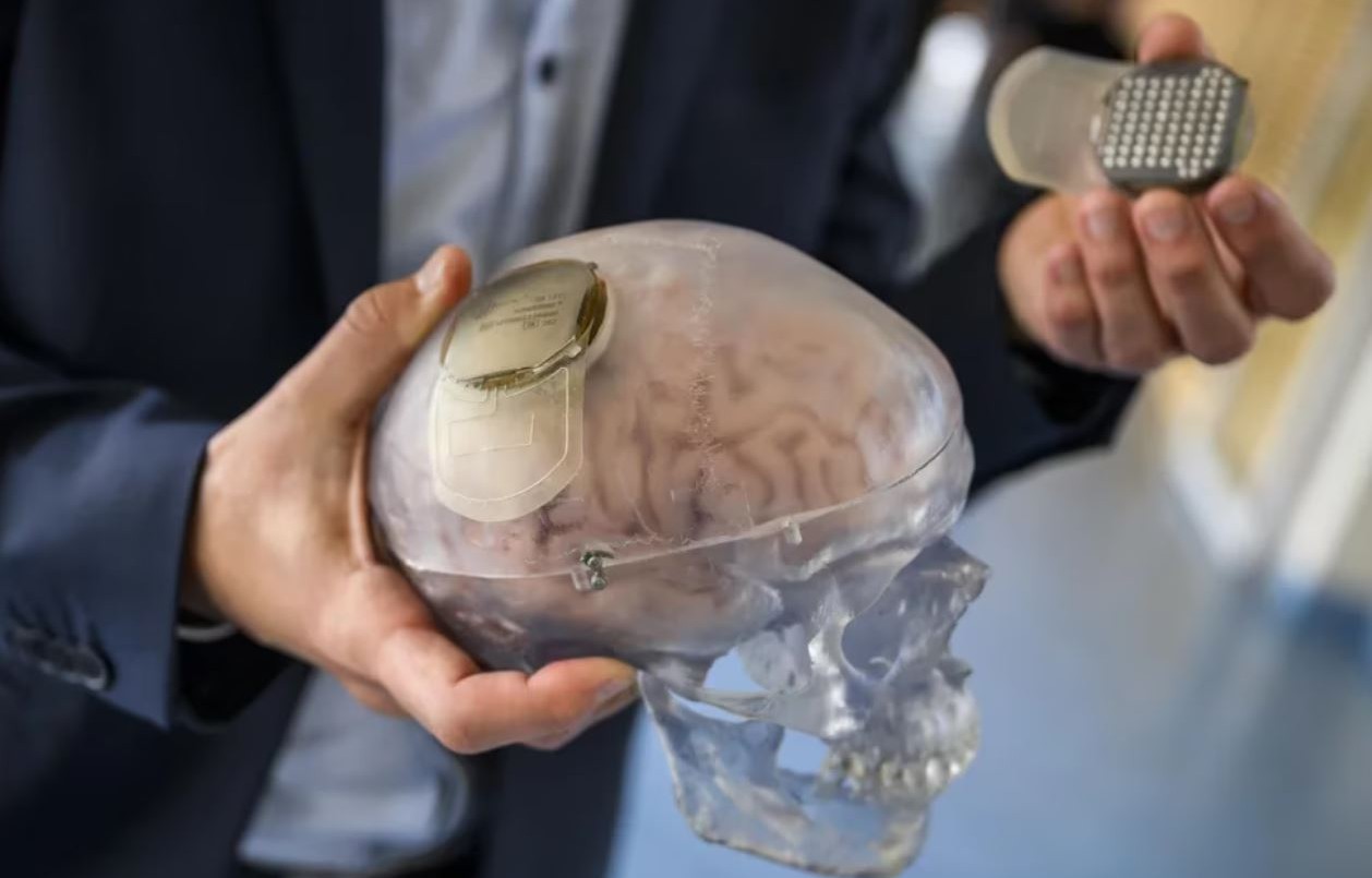 Un implante a prueba permite ayudar a una persona tetrapléjica a mover los brazos y las manos | Actualidad