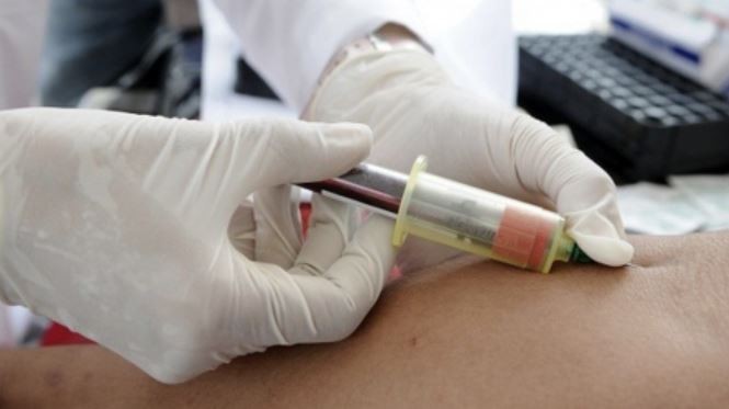 Copagos: bioquímicos también cobrarán un extra a pacientes de prepagas | Actualidad