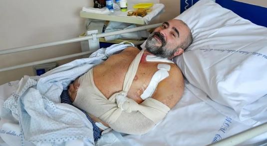 Expectativa en Italia por una operación pionera: un hombre recuperaría el uso de la mano | Internacionales