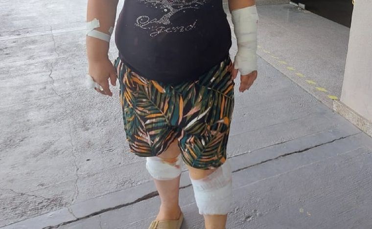 Una jauría atacó a una mujer mientras esperaba el colectivo | Actualidad