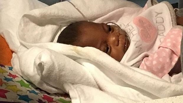 El bebé que nació con 283 gramos y logró sobrevivir | Curiosidades