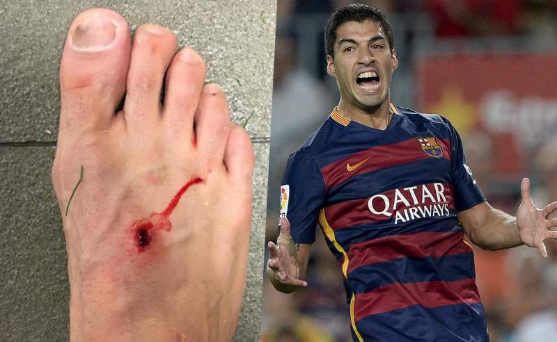 "El fútbol es para hombres", le respondió Suárez  a Filipe Luis tras la foto del pie lastimado | Deportes