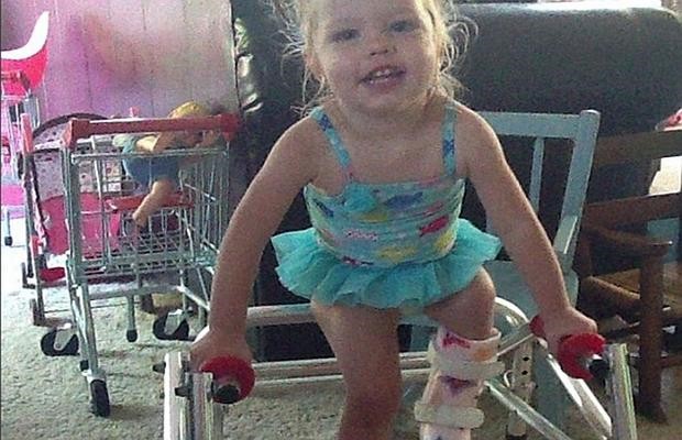 La mujer que tuvo que quebrar 300 veces la pierna de su hija para evitar una amputación | Curiosidades