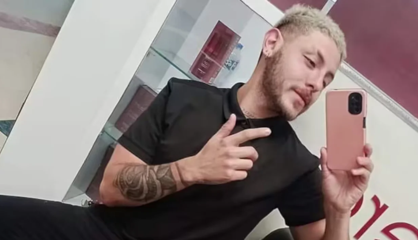 Viruela del mono: murió el joven cordobés que contrajo la enfermedad en México | Actualidad