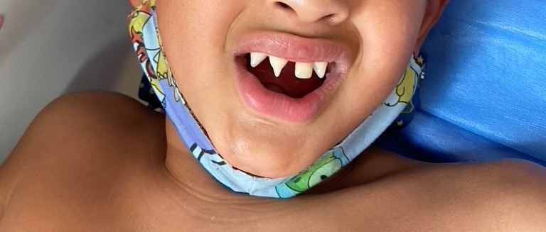 Genodermatosis: el poder del diagnóstico precoz | Actualidad