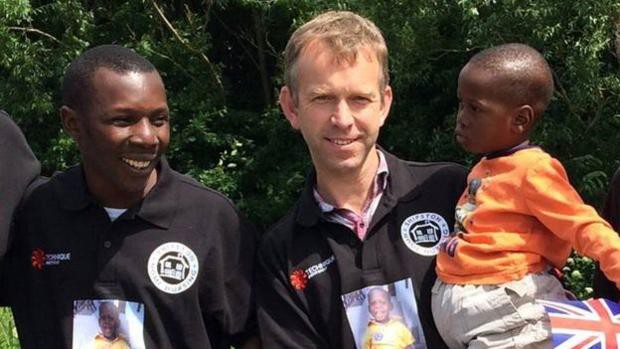 El extraño caso del nene al que los órganos le crecieron fuera del cuerpo | Curiosidades