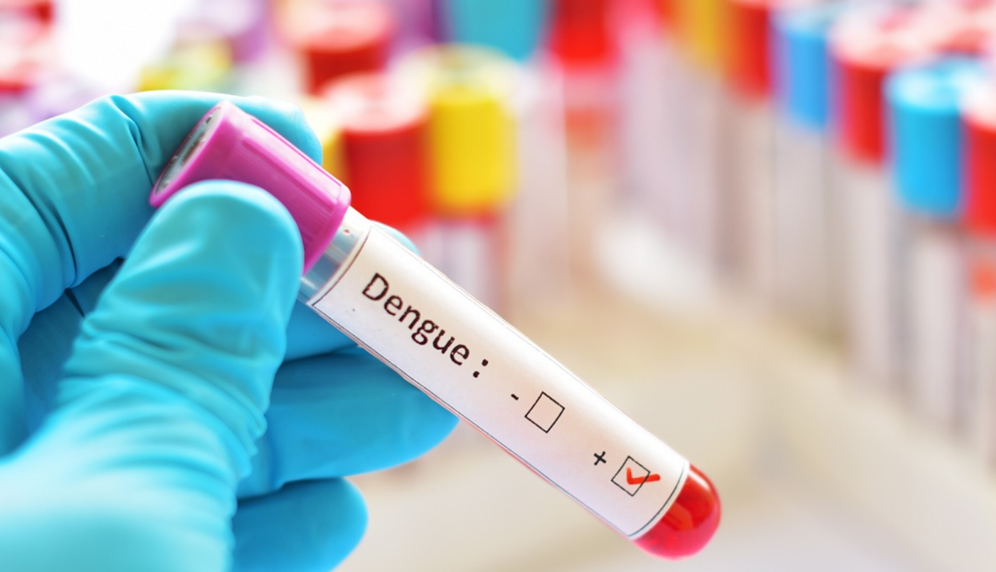 Anmat aprobó un nuevo kit para conocer el diagnóstico de dengue | Actualidad