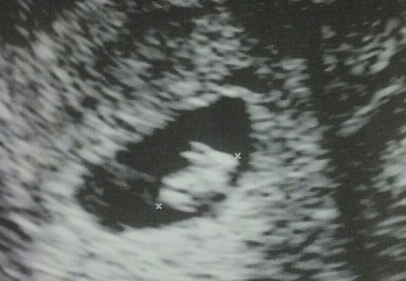 Foto viral: se hizo una ecografía y pensó que iba a tener un conejo | Curiosidades