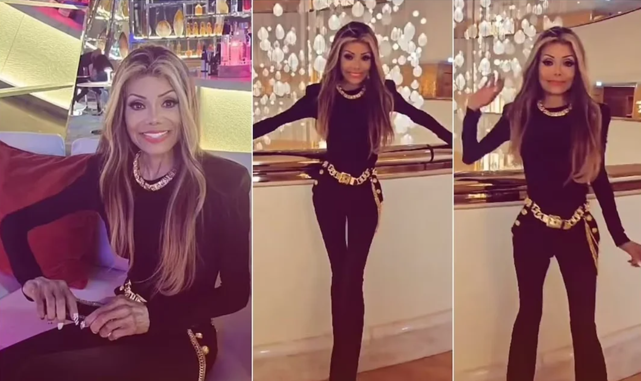 Preocupación por la extrema delgadez de la hermana de Michael Jackson: qué le pasa a La Toya | Espectáculos