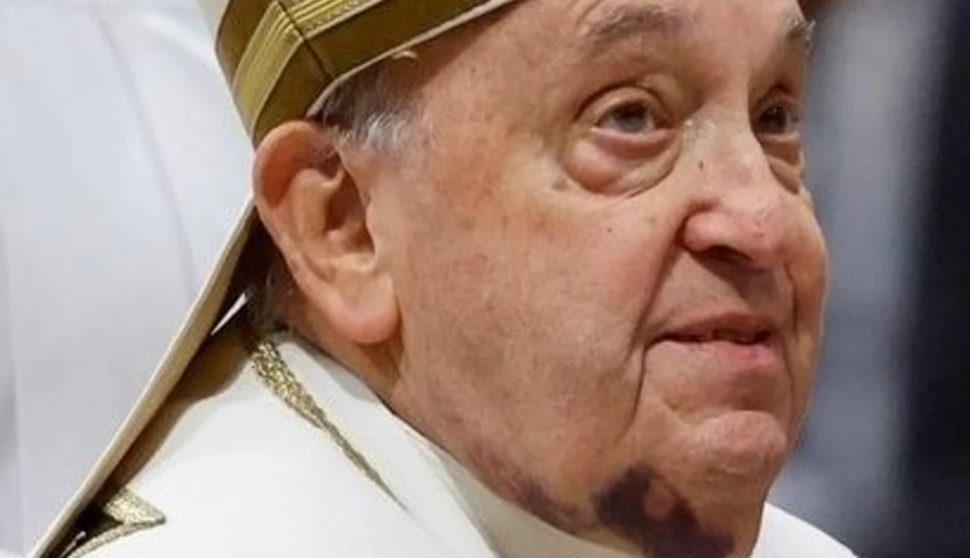 El Papa Francisco permanece en estado crítico y preocupa su insuficiencia renal | Actualidad