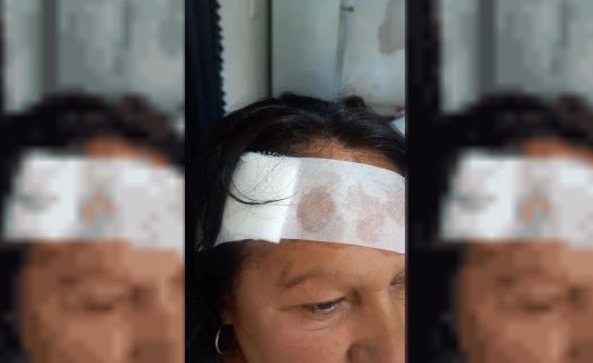 Brutal asalto en La Plata: golpearon con un arma a una mujer de 60 años para robarle | Actualidad