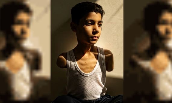 La imagen de un niño mutilado en Gaza ganó el premio a la Foto del Año | Internacionales