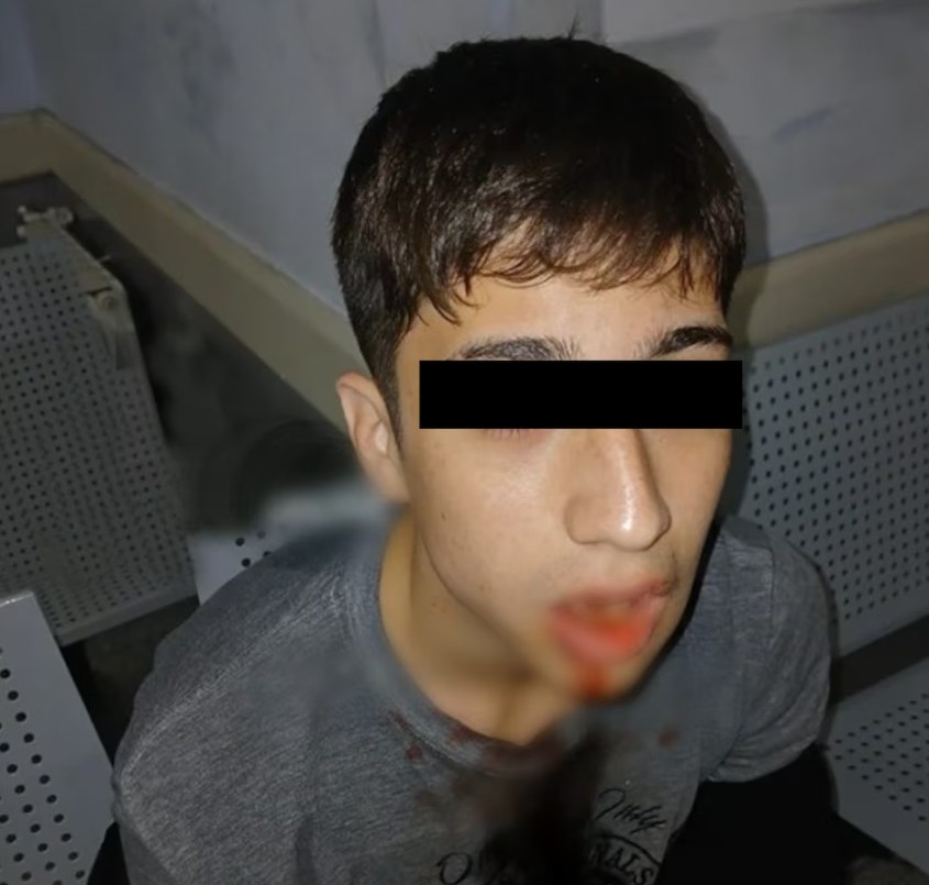 Un adolescente golpeó a otro y le fracturó la mandíbula durante un partido de fútbol | Actualidad