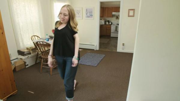 El drama de Jasmin Floyd, la mujer a la que le crece un segundo esqueleto en el cuerpo | Curiosidades