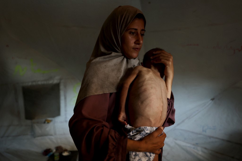 "Hambre masiva": organizaciones humanitarias alertan sobre la desnutrición infantil en Gaza | Internacionales