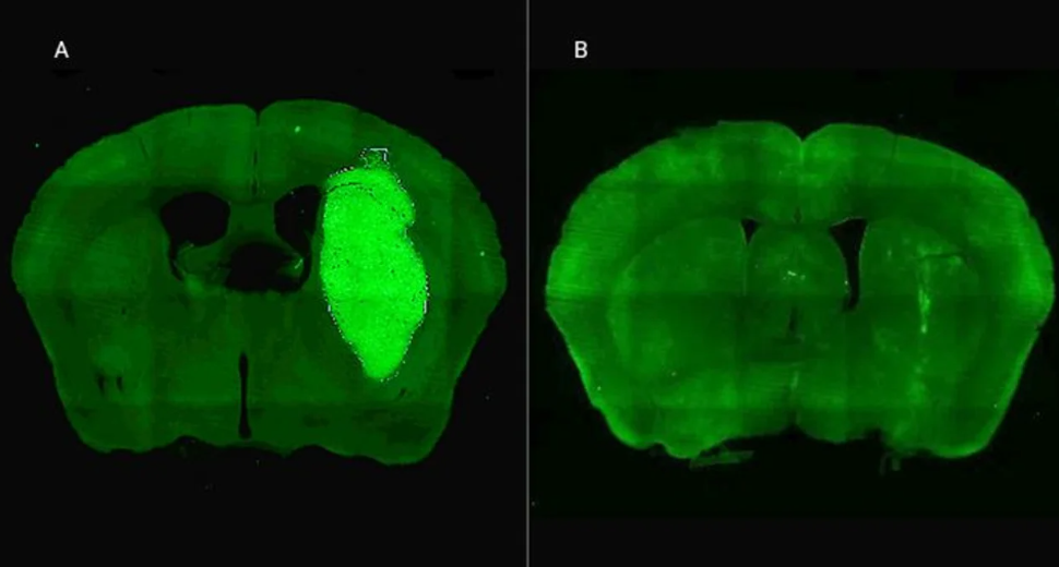 Especialistas del CONICET lograron frenar un tipo de cáncer cerebral con una novedosa estrategia terapéutica | Actualidad
