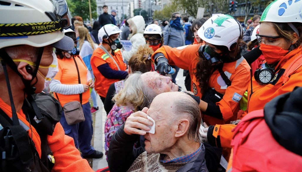 Una manifestante denunció la represión recibida por parte de la Policía en una de las marchas de jubilados | Actualidad