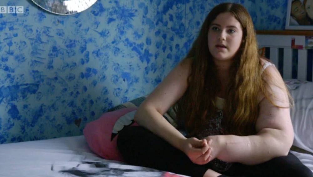 El extraño caso de la chica a la que le crece un brazo sin parar | Curiosidades