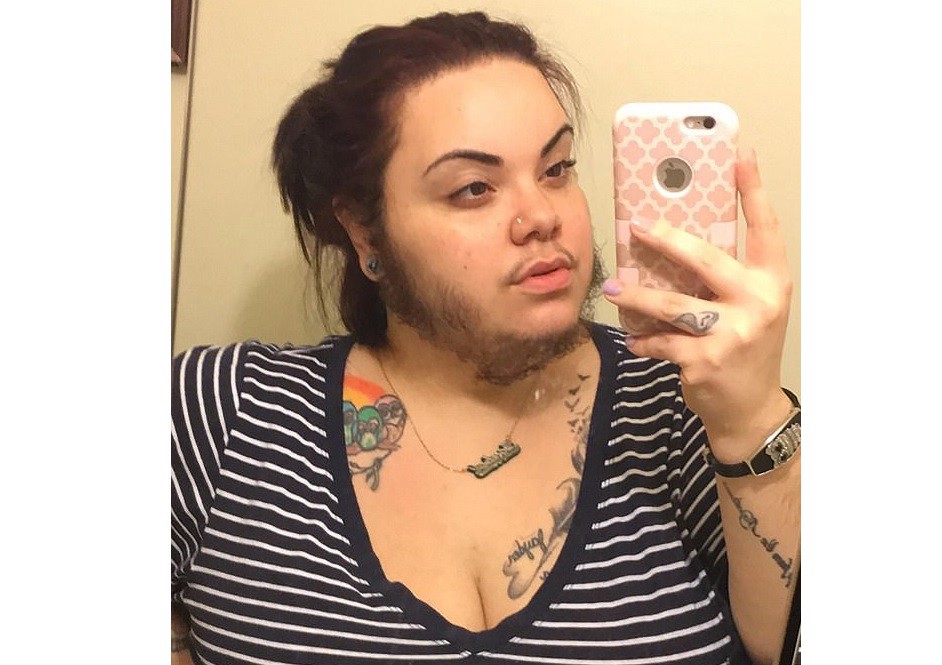 Cansada de los insultos decidió dejarse la barba, producto de un desorden hormonal | Curiosidades