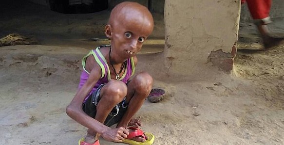 Como Benjamin Button: tiene 21 años y vive atrapado en el cuerpo de un anciano de 160 | Curiosidades