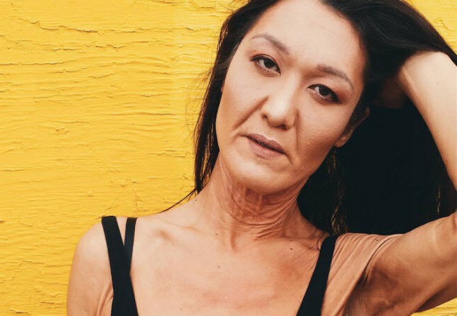 La joven modelo que sufre una rara enfermedad y esta "orgullosa" de sus arrugas | Curiosidades