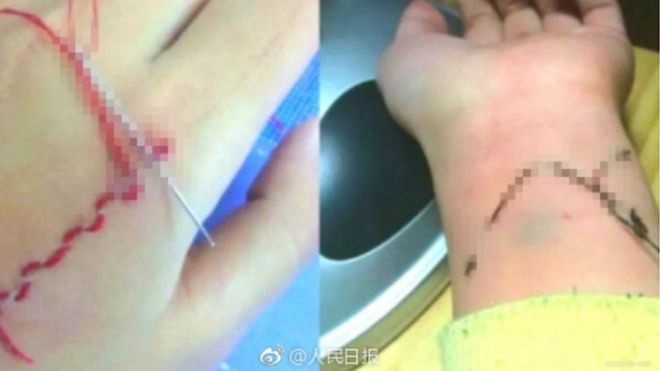 Alerta en China por un juego en el que los jóvenes se bordan la piel | Curiosidades